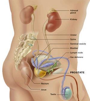 BEST DOCTORS PRZYKŁADOWE ZDARZENIA Choroba: rak prostaty. Leczenie: chirurgia robotowa.