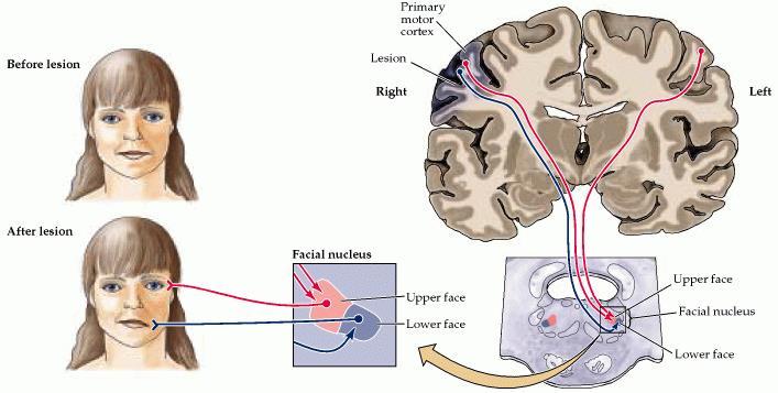 Nowy pogląd na mechanizm ośrodkowego porażenia nerwu twarzowego Morecraft i wsp.