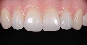HT-EXW HT-BLE HT-E57 HT-E58 HT-E59 HT-E60 rednia przeziernoπê (MT) MT-B00 MT-B0