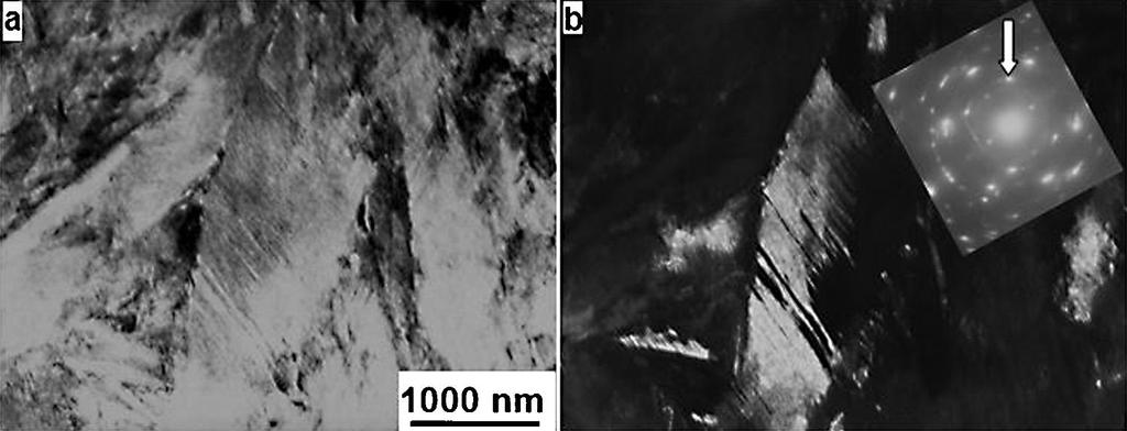 Fig. 6. TEM images in bright (a) and dark (b) field, made in the selected diffraction reflex (depicted by arrow) showing micro twins in martensitic plates rise. Rys.6. Obrazy TEM w polu jasnym (a) i ciemnym (b), obraz dyfrakcyjny świadczy o dużym zdefektowaniu mikrostruktury.
