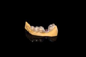 preferowany implant (łącznik) oraz tuleję z szerokiej biblioteki Planmeca Romexis i znajdź jego