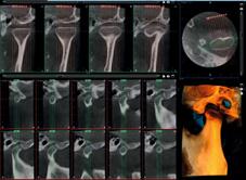 Ari Mäkelä, stomatolog Centrum Dentystyczne Janne, Järvenpää, Finlandia Zakupiłem system Planmeca ProMax 3D s we wrześniu 2010 roku, więc używam go już trzy lata.