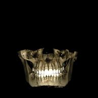 Unikatowa kombinacja 3D Zdjęcie twarzy 3D Porównania stanu przed i po zabiegu Planmeca ProFace to wyjątkowy system