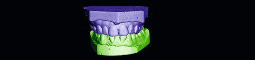 miejsca Modele cyfrowe 3D są przechowywane w bazie danych oprogramowania Planmeca