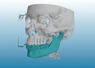 ProMax 3D Mid lub Planmeca ProMax 3D Max z funkcją