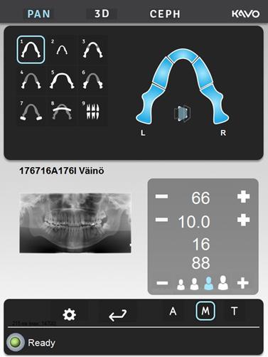 4 Programy pantomograficzne 4.4 ORTHOfocus Zdjęcia pantomograficzne można wykonywać, używając funkcji ORTHOfocus, która służy do automatycznego obliczania wyraźnej warstwy.
