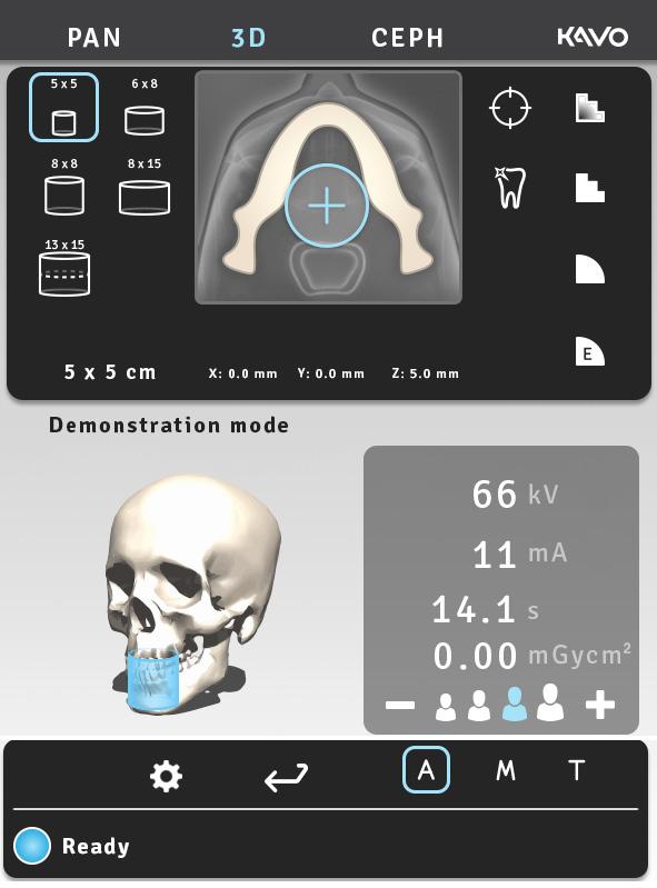 4 Programy pantomograficzne Po wybraniu funkcji ADC dla obrazowania 3D na początku sekwencji obrazowania wykonywane jest jedno krótkie (0,1 ms) ujęcie w projekcji tylno-przedniej (PA) umożliwiające