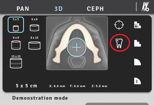 4 Programy pantomograficzne Ekran dotykowy aparatu OP 3D Pro: Przycisk MAR jest WŁĄCZONY. Przycisk MAR staje się widoczny w trybie 3D.