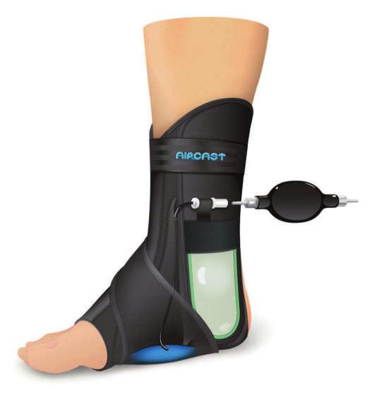 Stabilizator stawu skokowego AirLift ( P) NFZ: J.
