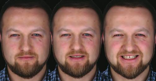 1 Zdjęcie an face oraz oba profile twarzy przy zamkniętych