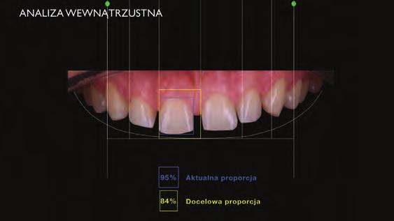 Ryc. 11 Porównanie obecnej i docelowej