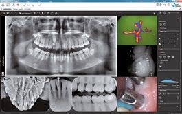 VistaSoft centrala diagnostyczna Państwa gabinetu Optymalne wsparcie diagnostyki dzięki intuicyjnej obsłudze Nowoczesny, ergonomiczny design zapewnia wysoką efektywność Możliwość pracy w sieci i