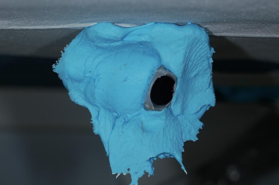 In order to plan prosthetic treatment for missing teeth, the analysis of intraoral conditions with the use of wax patterns was necessary.