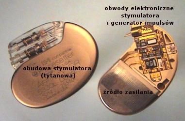 3. Wszczepialne urządzenia podtrzymujące rytm pracy serca Układ stymulujący składa się ze stymulatora (rys.