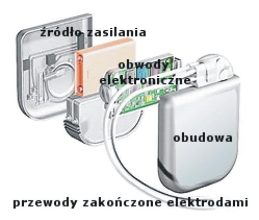 3. Wszczepialne urządzenia podtrzymujące rytm pracy serca stymulacyjna i defibrylacyjna w prawej komorze) lub dwujamowy (dodatkowa elektroda w prawym przedsionku możliwość stymulacji dwujamowej).