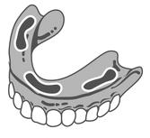 Dzwoń: Beata 718-383-7207 ***** ***** ***** REPAIRS of DENTAL PROSTHESIS If you are in need of immediate repairs of your dental prosthesis you do not have to look far.