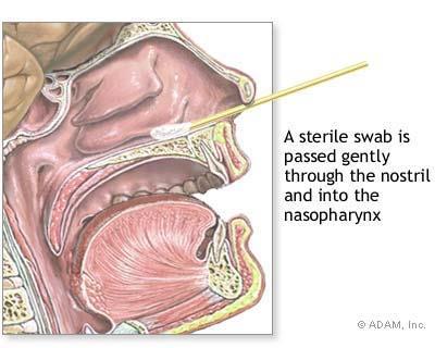 Diagnostyka grypy Materiał wymaz z gardła, nosa, nosogardzieli aspirat, popłuczyny z nosogardzieli popłuczyny z nosa popłuczyny z