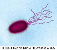 Pseudomonas aeruginosa Pałeczka ropy błękitnej - ropne zakażenia u ludzi i zwierząt (pneumonia, enteritis, vaginitis,