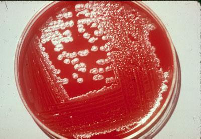 Bacillus
