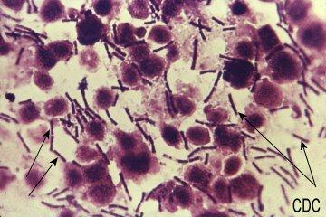 Bacillus