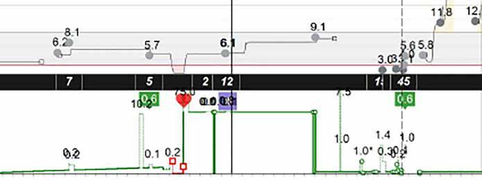 Raport Sensor i glukometr - info. Raport Sensor i glukometr - info. przedstawia dane z pompy insulinowej pacjenta, glukometru i sensora glukozy.