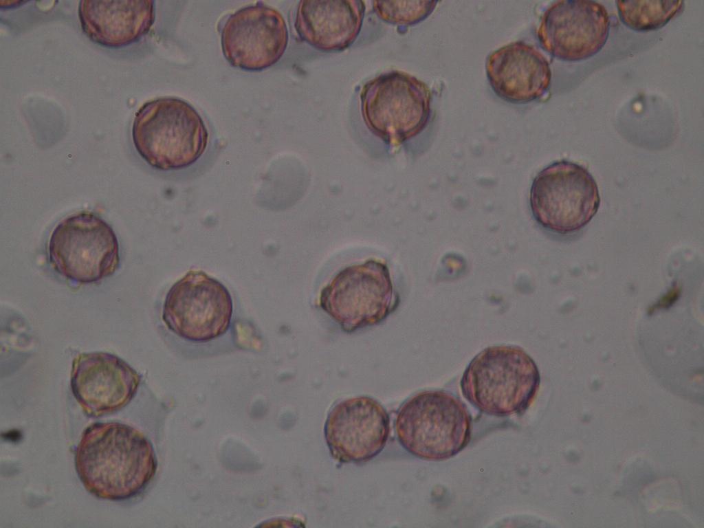 Ryc. 5. Ziarna pyłku brzozy w aparacie Lanzoni VPPS 2000 w okresie intensywnego pylenia 22 kwietnia 2014 r. Photo 5.
