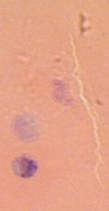 Borrelia