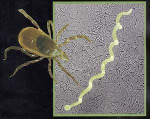 Choroba z Lyme Po raz pierwszy rozpoznana w USA w 1975 przez Dr. Allen Steere, jako młodzieńcze reumatoidalne arthritis występujące endemicznie latem w Lyme.