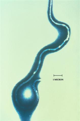 Biologia Borrelia burgdorferi Borrelia burgdorferi jest ruchliwym krętkiem z aksjalną endoflagellą.