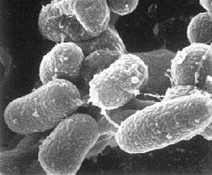 Mycobacterium