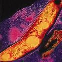 Podział prątków Ze względów praktycznych prątki dzieli się na: prątki właściwe MTC (Mycobacterium tuberculosis complex) - wywołujące gruźlicę Mycobacteium leprae - wywołujące
