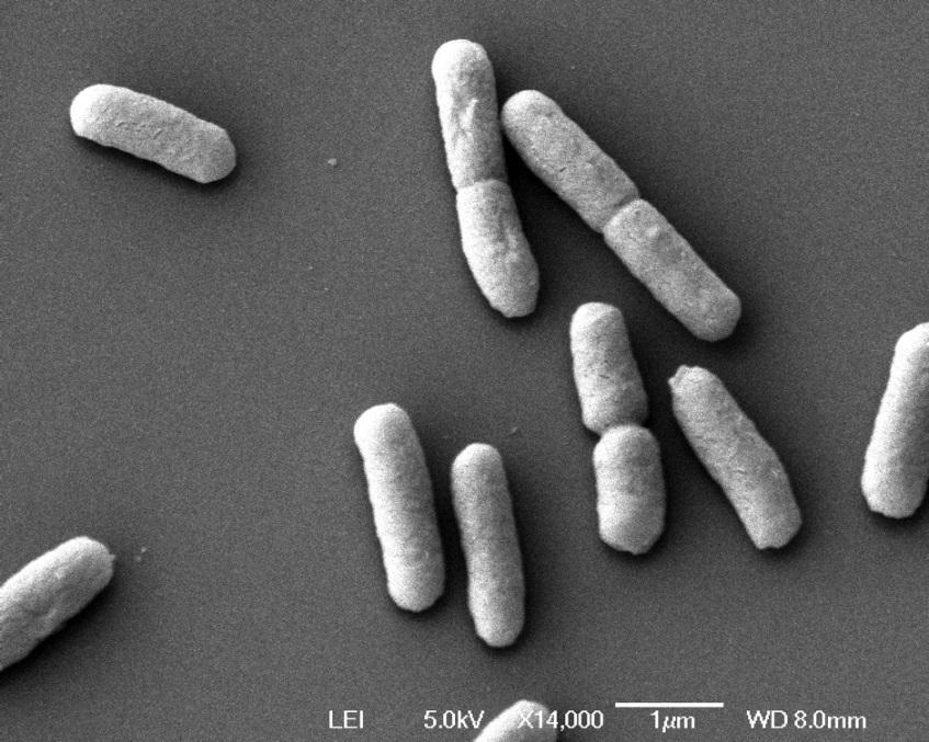 8 Pomiędzy 4300 a 2700 milionów lat temu Fig. 8 - Zdjęcie bakterii wykonane skaningowym mikroskopem elektronowym.