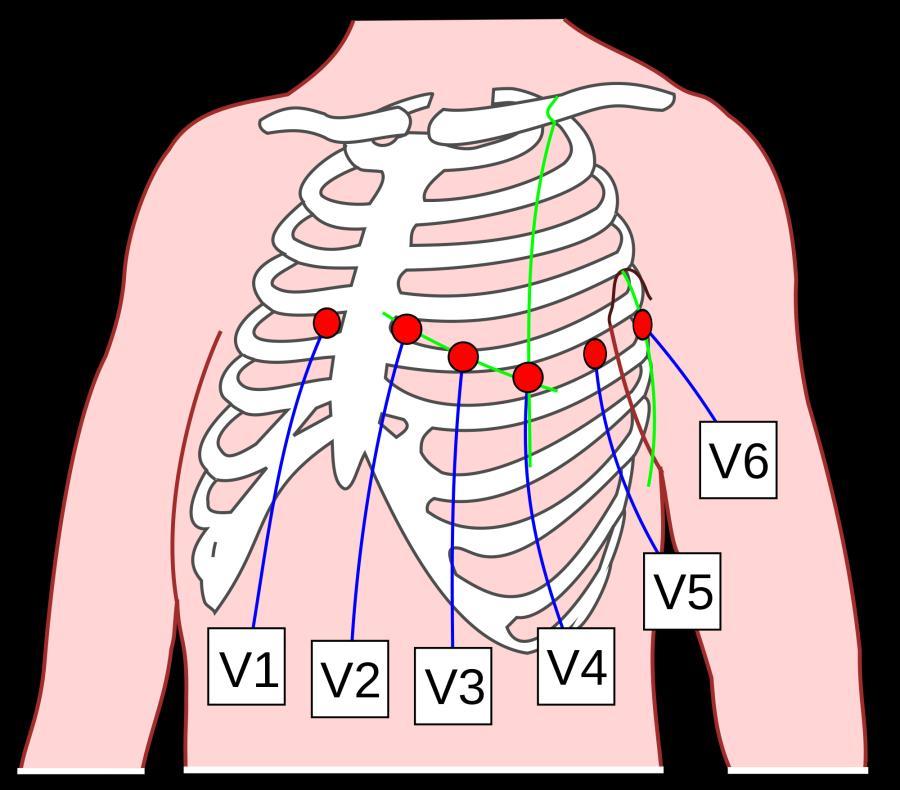 EKG widocznych jest