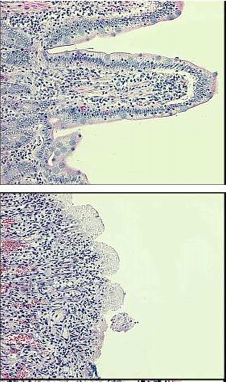 Ischemia i reperfuzja - Uszkodzenie tkanek po ischemii i reperfuzji jest powodowane przez wzrost produkcji ROS (szczególnie istotne przy transplantacji narządów): * Podawanie zmiataczy O 2 ' - i H 2
