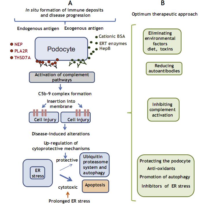* * Galsulfataza (rekombinowana arylsulfataza) stosowana w MPS t. IV Dębiec H, et al. J Am Soc Nephrol.