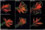 Filopodia Lamellipodia by Ken Balazovich Filopodia J Cell Sci. 2003 Jan 15;116(Pt 2):239-46.