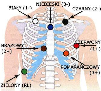 Zamocowanie 5-elektrodowe: KANAŁ 1: [+] BRĄZOWY - 5. ŻEBRO, LEWA LINIA PACHOWA PRZEDNIA [ - ] CZERWONY - OBOJCZYK, NA ŚRODKU KANAŁ 2: [+] CZARNY - 5.