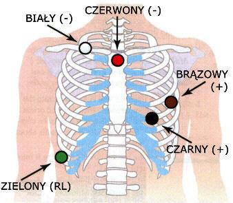 5-2: Zamocowanie 5-elektrodowe Uwaga: Podłączenie 7-elektrodowe pokazane poniżej posiada niezależne bipolarne odprowadzenia i jest zgodne z zaleceniami CODE 2 norm IEC60601-2-47.