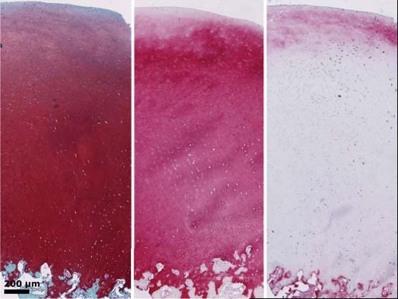 Histologia biopsyjna parametry strukturalne Leczenie metodą BST-CarGel poprawia strukturę tkanki w 13 miesięcy od rozpoczęcia procesu reperacji w biopsyjnej ocenie histologicznej Międzynarodowego