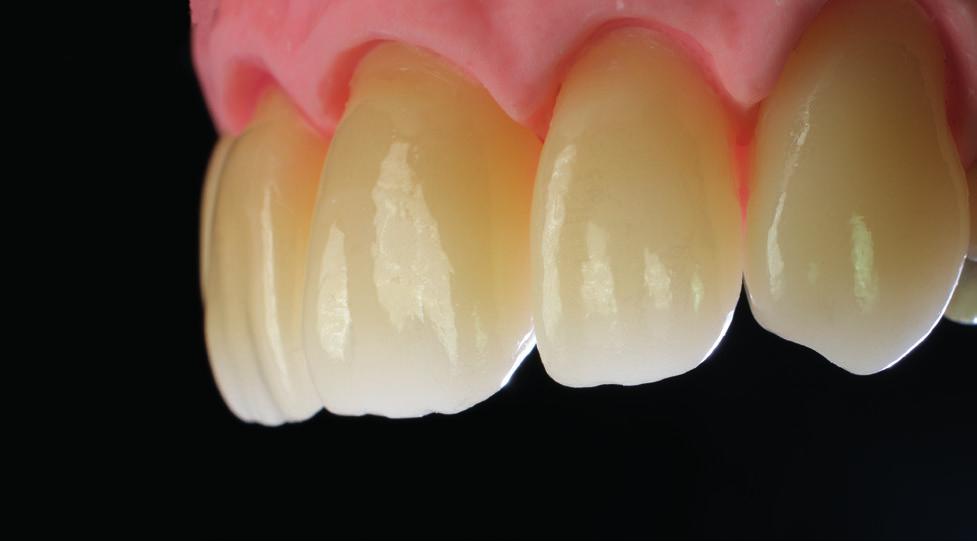 High Translucent priti multidisc ZrO2 multicolor High Translucent, cyrkon o mikrostrukturze kubicznej z przeziernością na poziomie 49% odcienie pritidenta pozycja VITA classical VITA System 3D-Master
