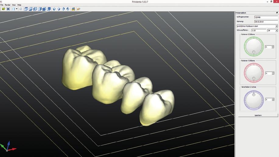 Akcesoria MPT Multicolor Positioning Tool pritidenta Oprócz innowacyjncyjnych bloczków priti multidisc ZrO2, oferujemy naszym klientom również aplikację, która sprawia, że konstrukcje powstają w
