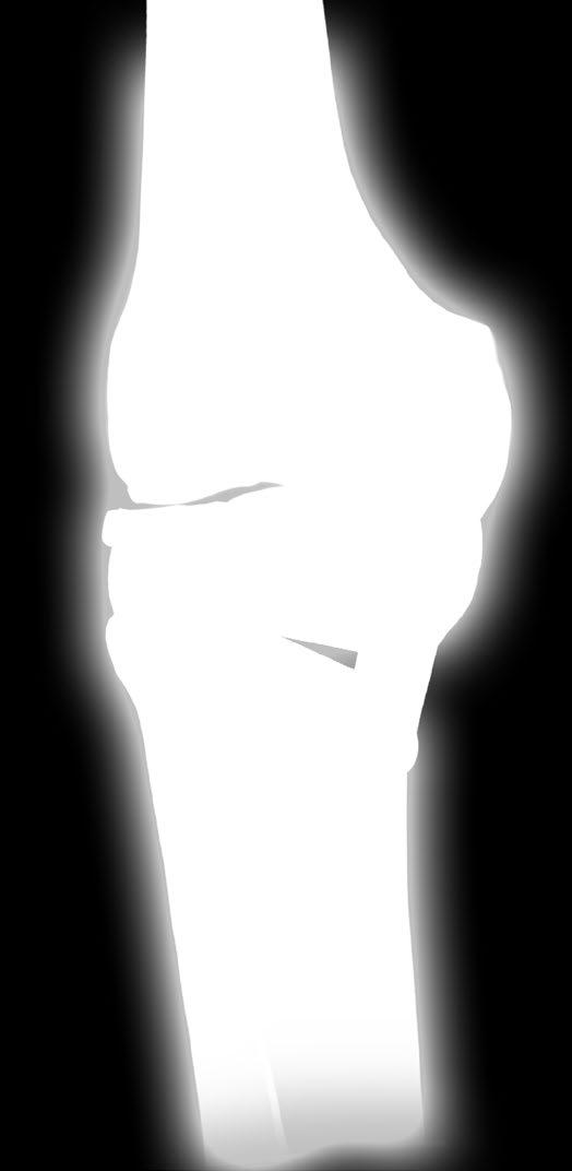 INSTRUMENTARIUM 40.5350.