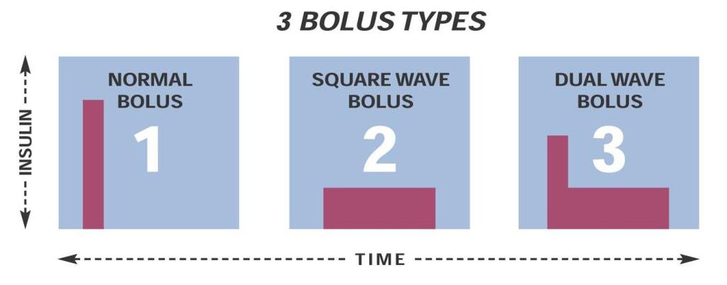 Co to jest Bolus doposiłkowy? Jest to ilość insuliny podana w związku z posiłkiem lub hiperglikemią.