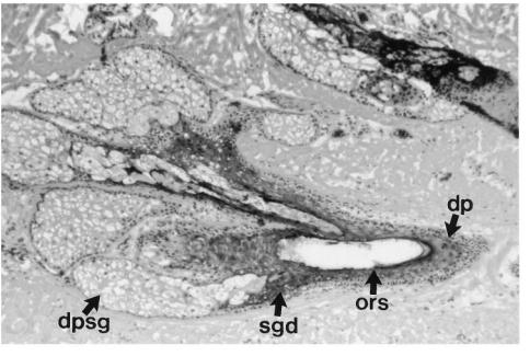 Azziz R. Idiopathic hirsutism. Endocr Rev. 2000 Aug; 21(4):347-62.