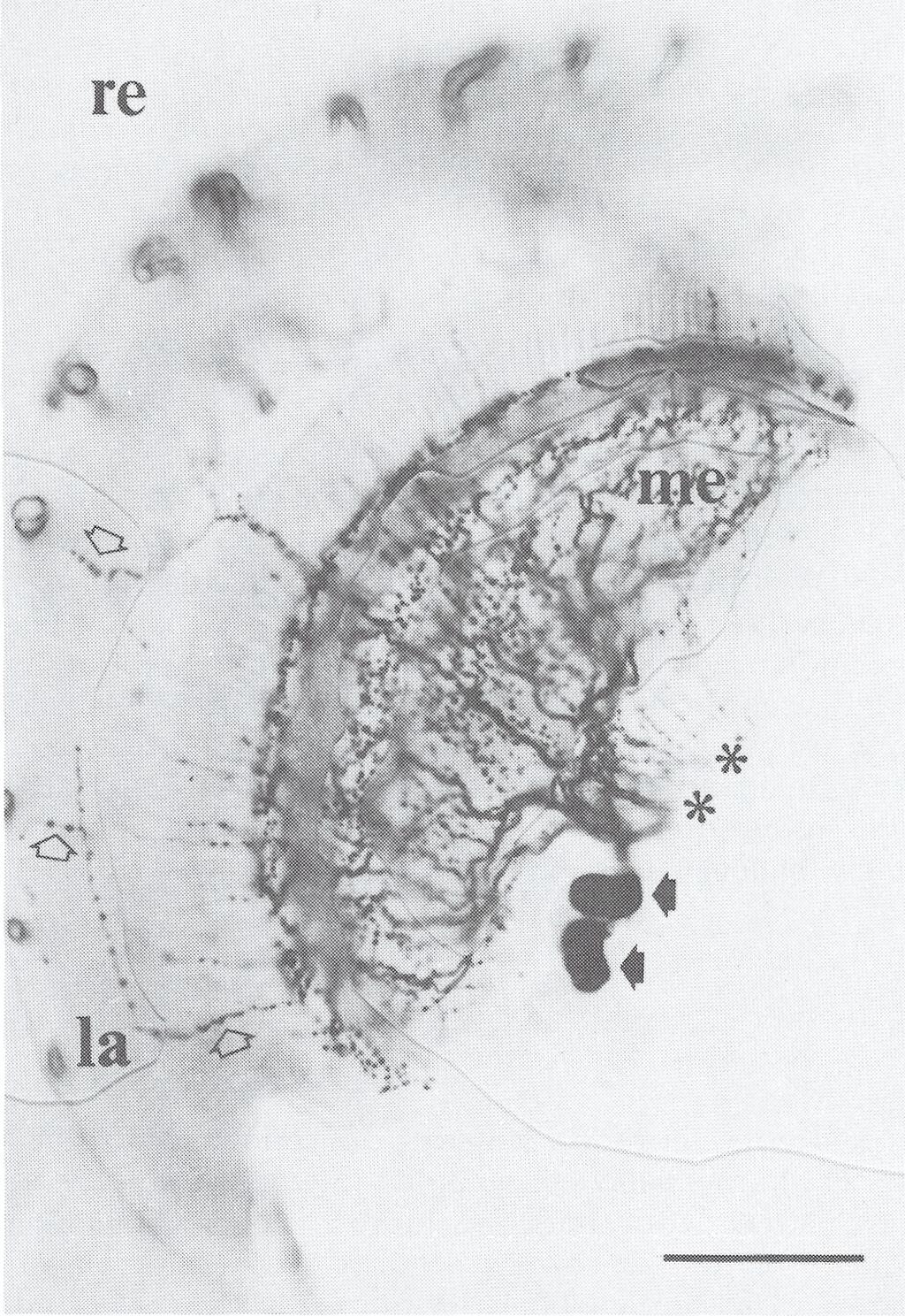 Neurony te wysyłają również aksony do przeciwległej medulla, więc część włókien widocznych na zdjęciu w medulla pochodzi z neuronów położonych w przeciwległej medulla.