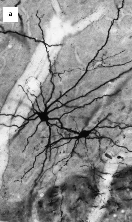 ) Motor neuron