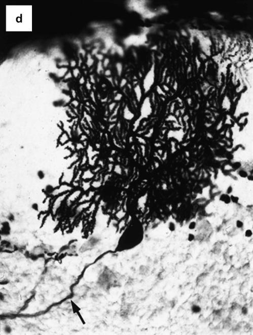 granule cell