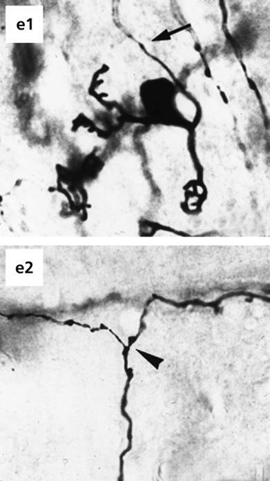 cerebellum, f)
