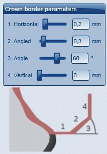 ZASTOSOWANIE Parametry krańcowe w oprogramowaniu CAD Ceramill Mind Stosując Ceramill Zolid Preshades należy zwrócić na to uwagę, aby parametry krańcowe zostały osiągnięte. Zalecane wartości to: _1.