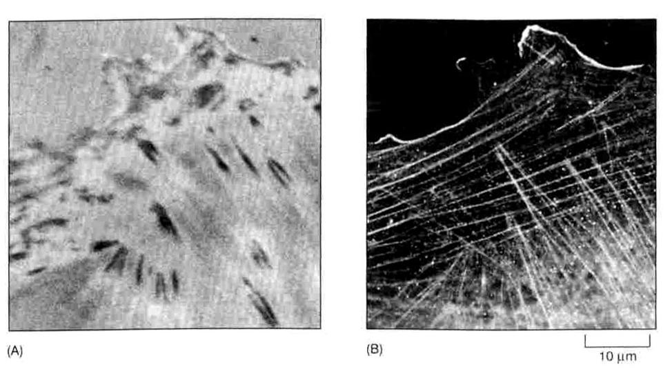 zogniskowanych - focal contacts Fibroblasty w hodowli: A) focal contacts-